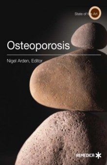 Osteoporosis (Illustrated)