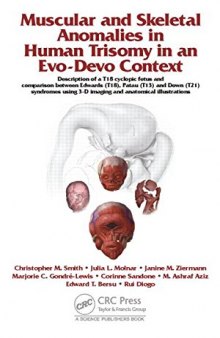 Muscular and Skeletal Anomalies in Human Trisomy in an Evo-Devo Context: Description of a T18 Cyclopic Fetus and Comparison Between Edwards