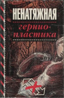 Ненатяжная герниопластика