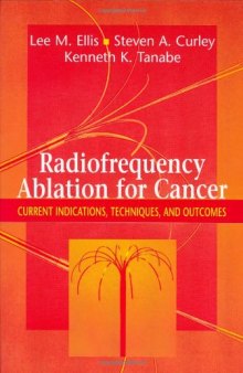 Radiofrequency Ablation for Cancer Current Indications, Techniques and Outcomes