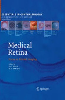 Medical Retina: Focus on Retinal Imaging