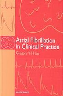 Atrial fibrillation in clinical practice