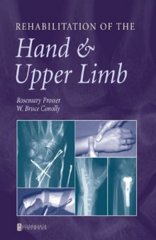 Rehabilitation of the Hand & Upper Limb