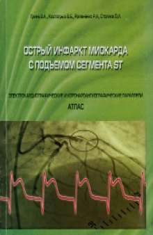 Острый инфаркт миокарда с подъемом сегмента ST. Электрокардиографические и коронароангиографическая параллели. Атлас