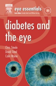 Eye Essentials:  Diabetes and the Eye