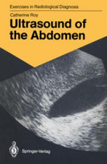Ultrasound of the Abdomen: 114 Radiological Exercises for Students and Practitioners