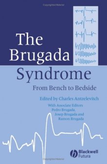 The Brugada Syndrome: From Bench To Bedside  