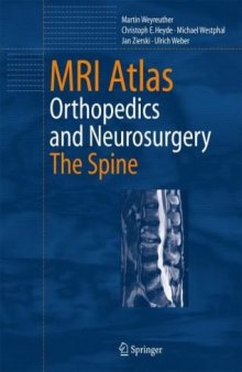 MRI Atlas of MS Lesions