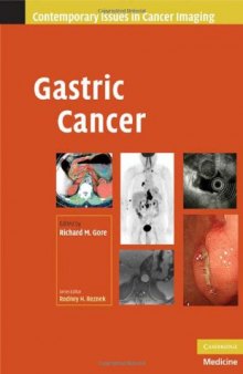 Gastric Cancer (Contemporary Issues in Cancer Imaging)