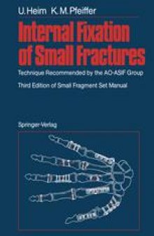 Internal Fixation of Small Fractures: Technique Recommended by the AO-ASIF Group