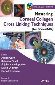 Mastering corneal collagen cross linking techniques