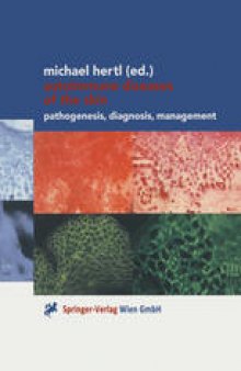 Autoimmune Diseases of the Skin: Pathogenesis, Diagnosis, Management