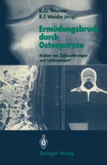 Ermüdungsbruch durch Osteoporose: Risiken von Zyklusstörungen und Leistungssport