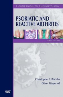 Psoriatic and Reactive Arthritis: A Companion to Rheumatology