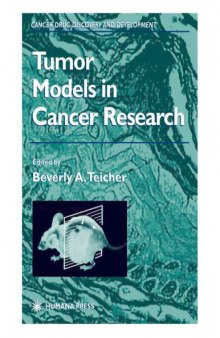 Tumor Models in Cancer Research