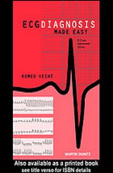 ECG diagnosis made easy