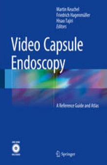 Video Capsule Endoscopy: A Reference Guide and Atlas