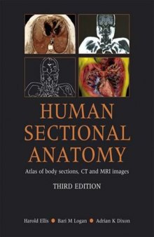 Human Sectional Anatomy: Atlas of Body Sections, CT and MRI Images - 3rd edition
