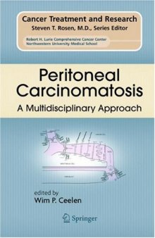 Peritoneal Carcinomatosis: A Multidisciplinary Approach (Cancer Treatment and Research)