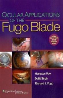 Ocular Applications of the Fugo Blade