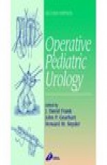 Operative Pediatric Urology