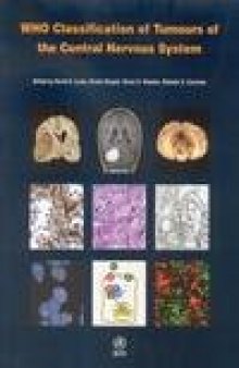 Who Classification of Tumours of the Central Nervous System (Who Classfication of Tumours)