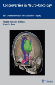 Controversies in neuro-oncology : best-evidence medicine for brain tumor surgery