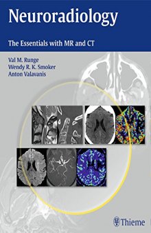 Neuroradiology: The Essentials with MR and CT