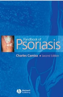 Handbook of Psoriasis, Second Edition