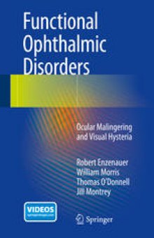 Functional Ophthalmic Disorders: Ocular Malingering and Visual Hysteria