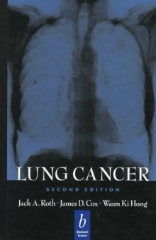 Lung Cancer  Second edition