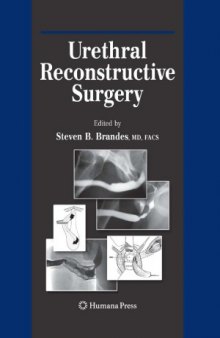 Urethral Reconstructive Surgery.