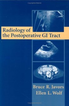 Radiologic Diagnosis of Gastric Cancer: A new Outlook