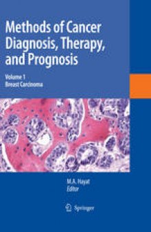 Methods of Cancer Diagnosis, Therapy and Prognosis: Breast Carcinoma
