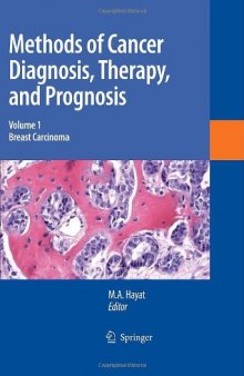 Methods of Cancer Diagnosis, Therapy and Prognosis: Breast Carcinoma (Methods of Cancer Diagnosis, Therapy and Prognosis, Volume 1)