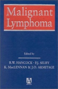 Malignant Lymphoma