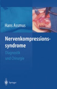 Nerven-kompressions-syndrome: Diagnostik und Chirurgie
