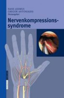 Nervenkompressionssyndrome