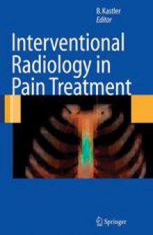 Interventional Radiology in Pain Treatment