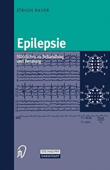 Epilepsie: Nutzliches zu Behandlung und Beratung