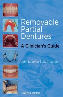 Removable Partial Dentures: A Clinician's Guide (Restorative Dentistry)