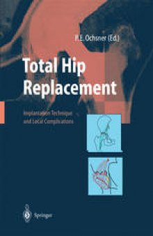 Total Hip Replacement: Implantation Technique and Local Complications