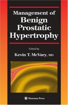 Management of Benign Prostatic Hypertrophy (Current Clinical Urology)