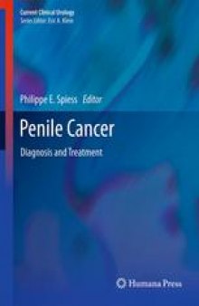 Penile Cancer: Diagnosis and Treatment
