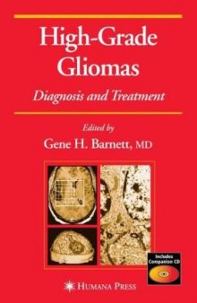High-grade gliomas: diagnosis and treatment