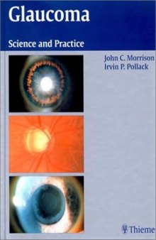Glaucoma. Science and Practice
