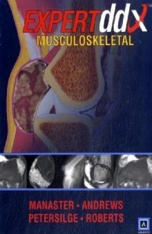 EXPERTddx : Musculoskeletal  