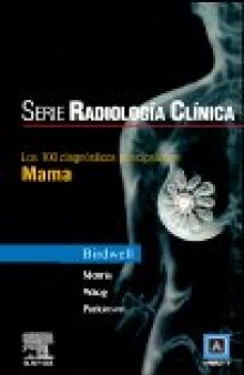 Serie Pocket de Radiologia: Los 100 Diagnosticos Principales en Mama (PocketRadiologist) Spanish 