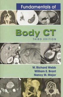 Fundamentals of Body CT (3rd Edition)  