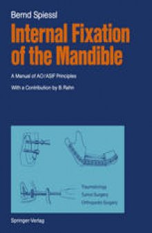 Internal Fixation of the Mandible: A Manual of AO/ASIF Principles